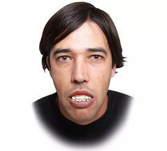 Dentadura con Brakets