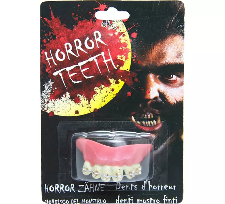 Translation missing: es.Dentadura con Brakets