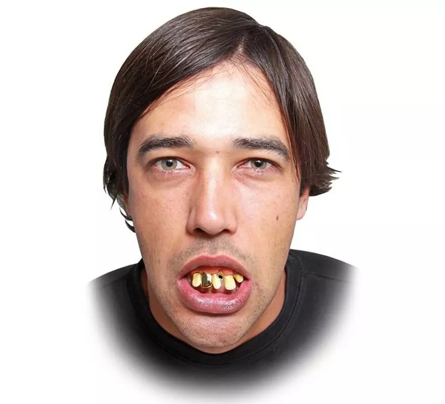 Translation missing: es.Dentadura con diente de oro