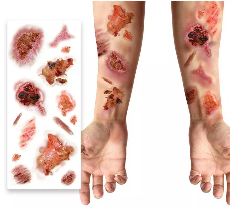 Tatuajes con Heridas Infectadas